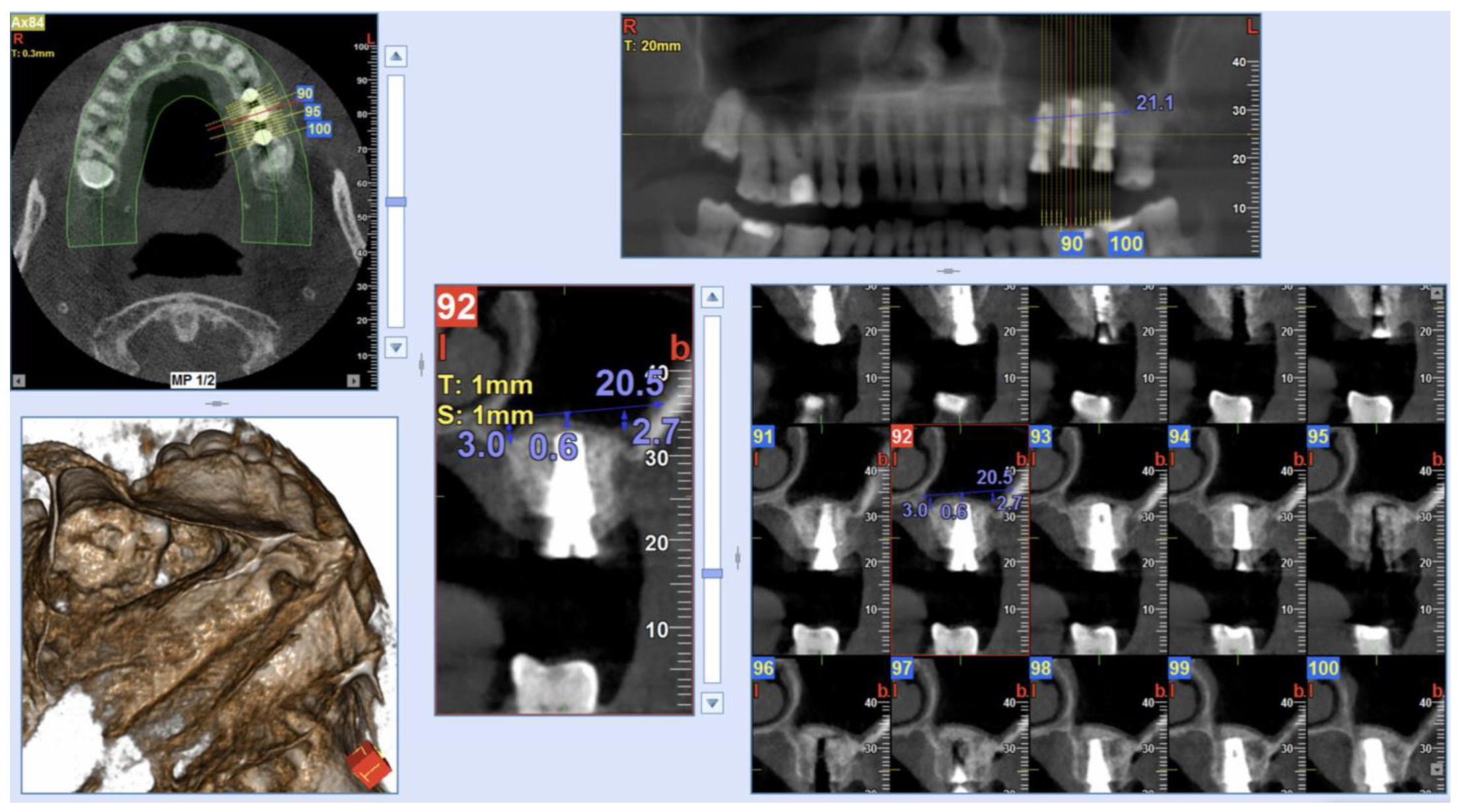 Ijerph 20 02583 g003 Ijerph 20 02583 g003