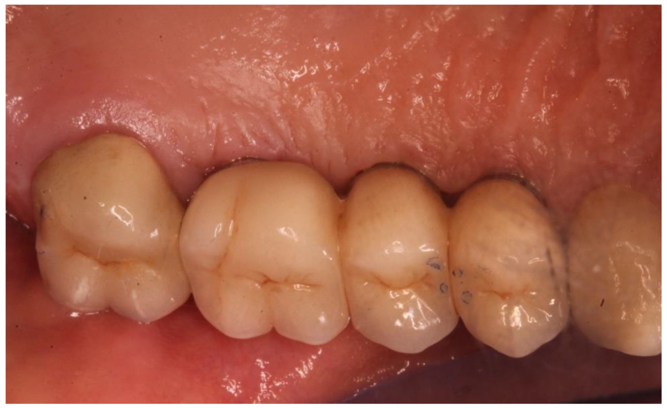 Ijerph 20 02583 g005 Ijerph 20 02583 g005