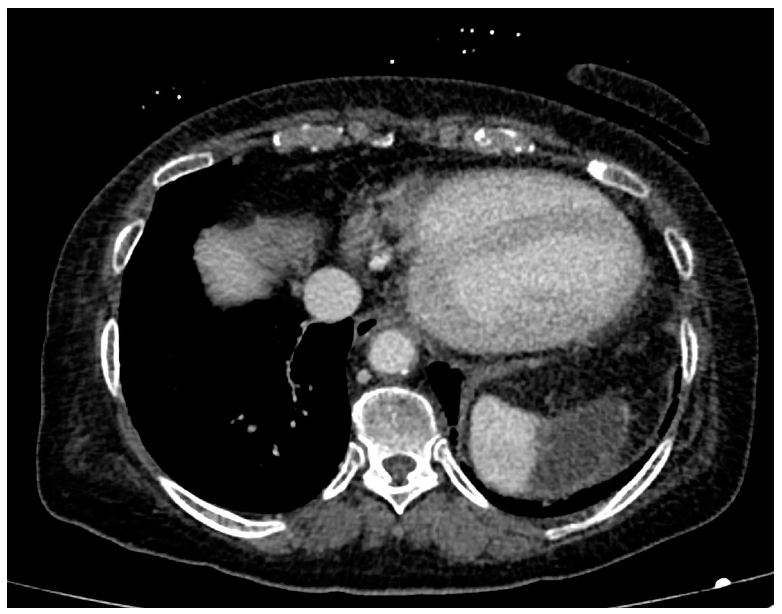 Ijerph 20 03868 g004