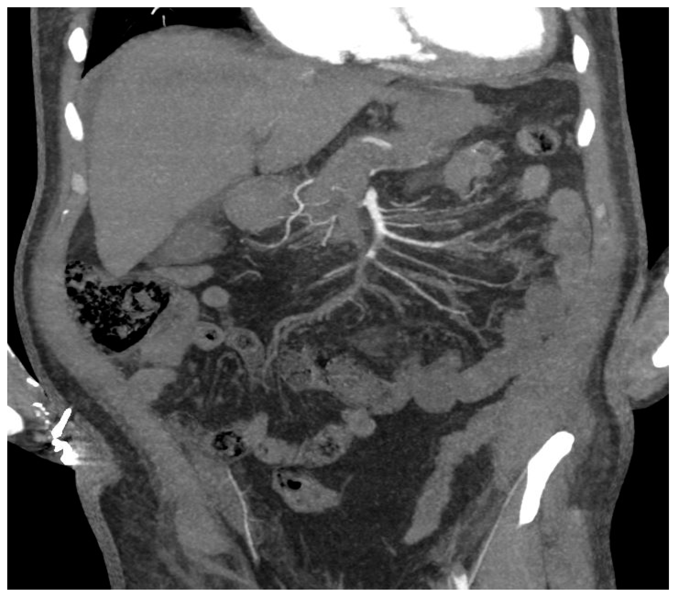 Ijerph 20 03868 g005