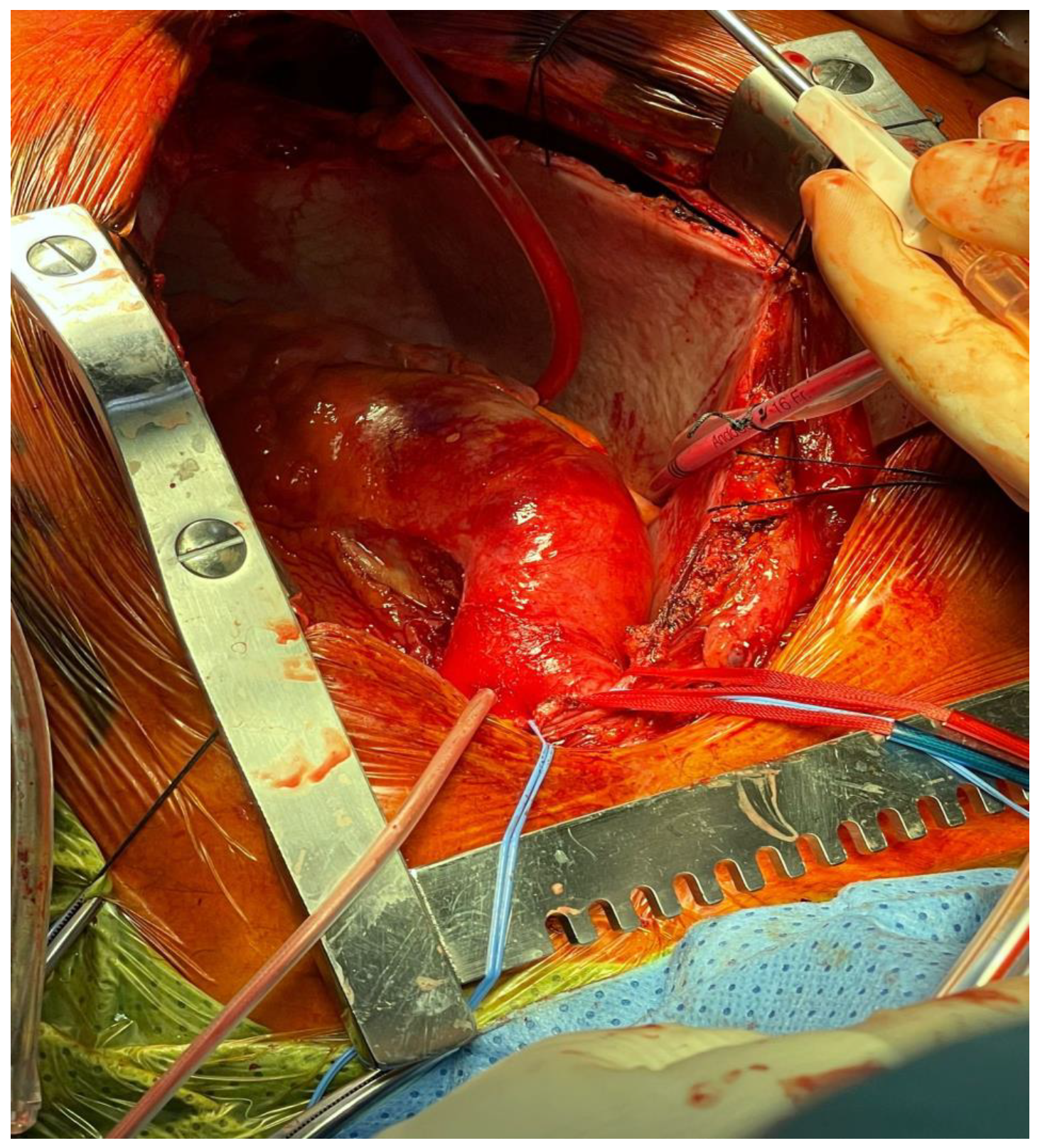 Ijerph 20 04094 g002 Ijerph 20 04094 g002