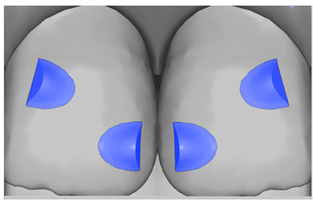 Ijerph 20 04481 i003