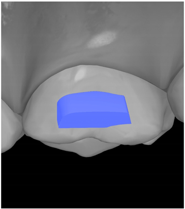 Ijerph 20 04481 i011