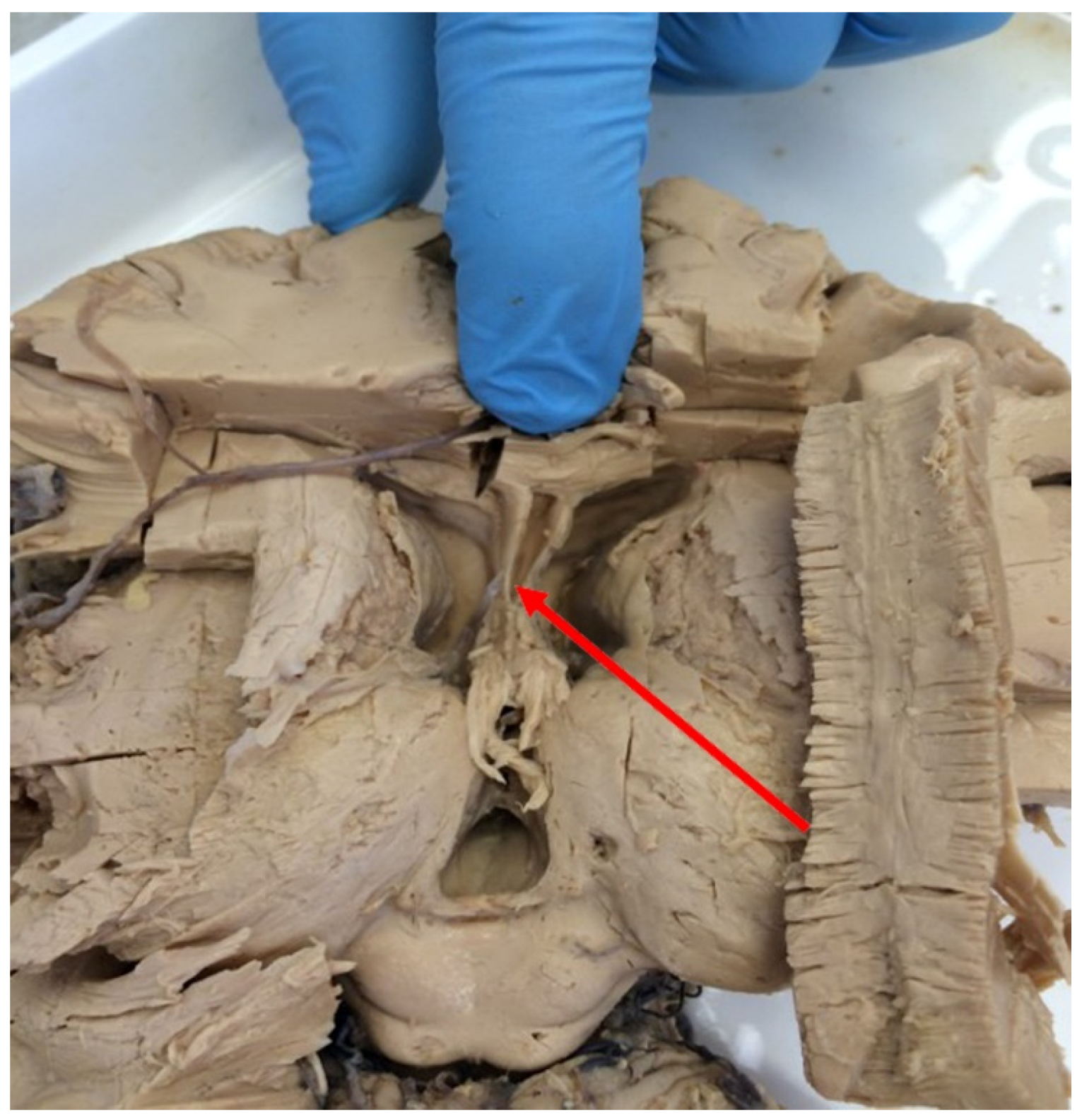 Ijerph 20 04592 g001