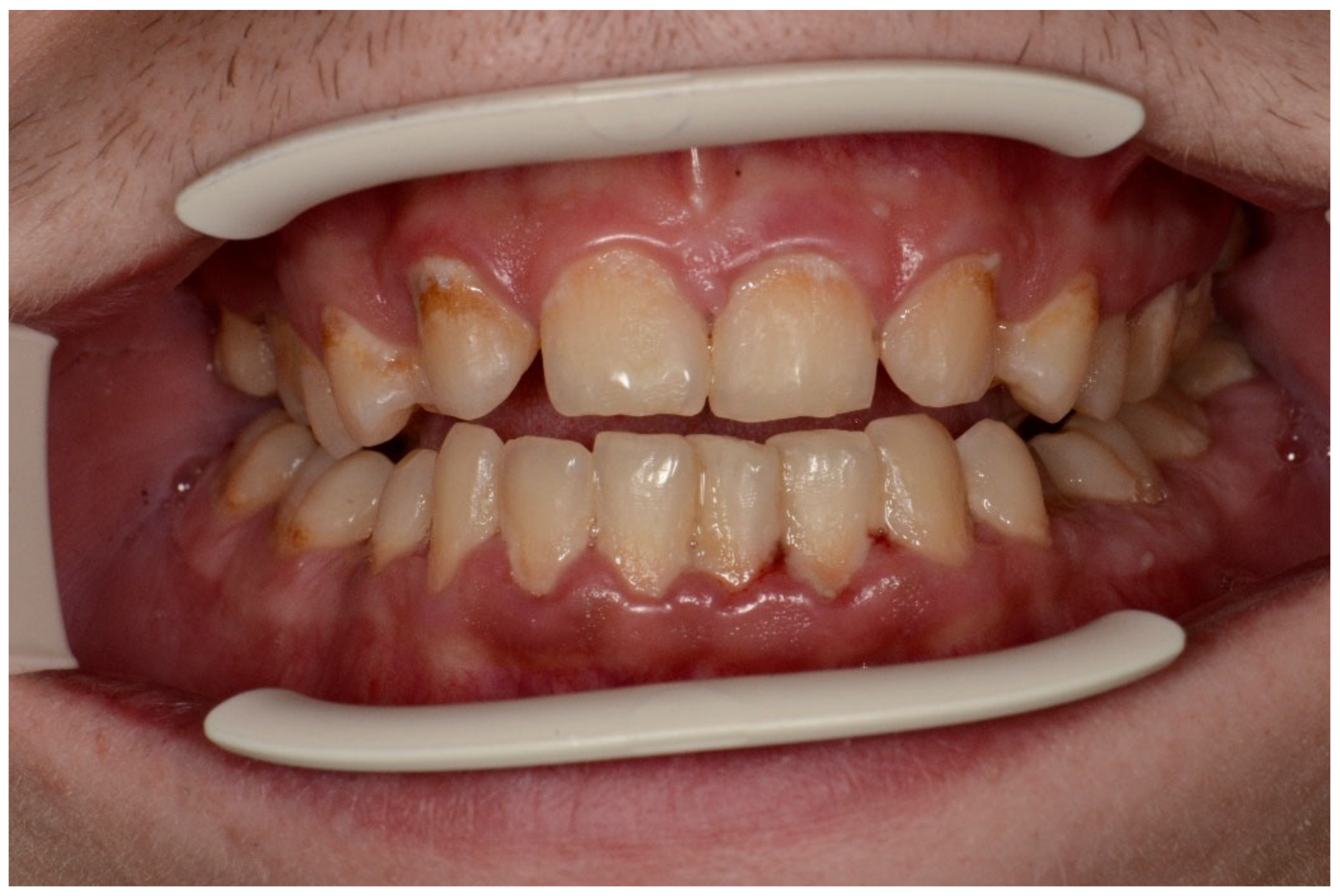 Ijerph 20 04792 g003