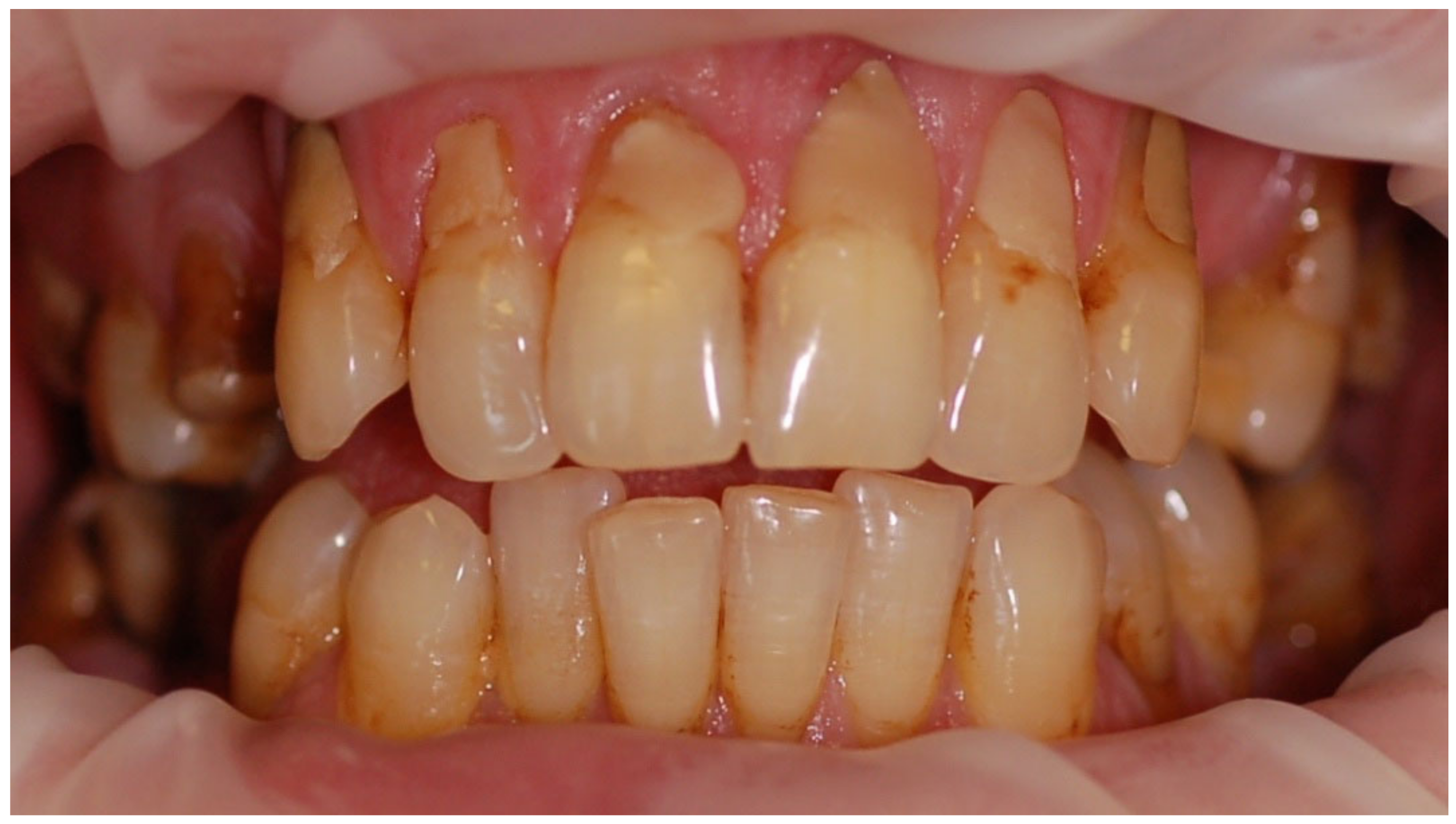 Ijerph 20 04792 g005