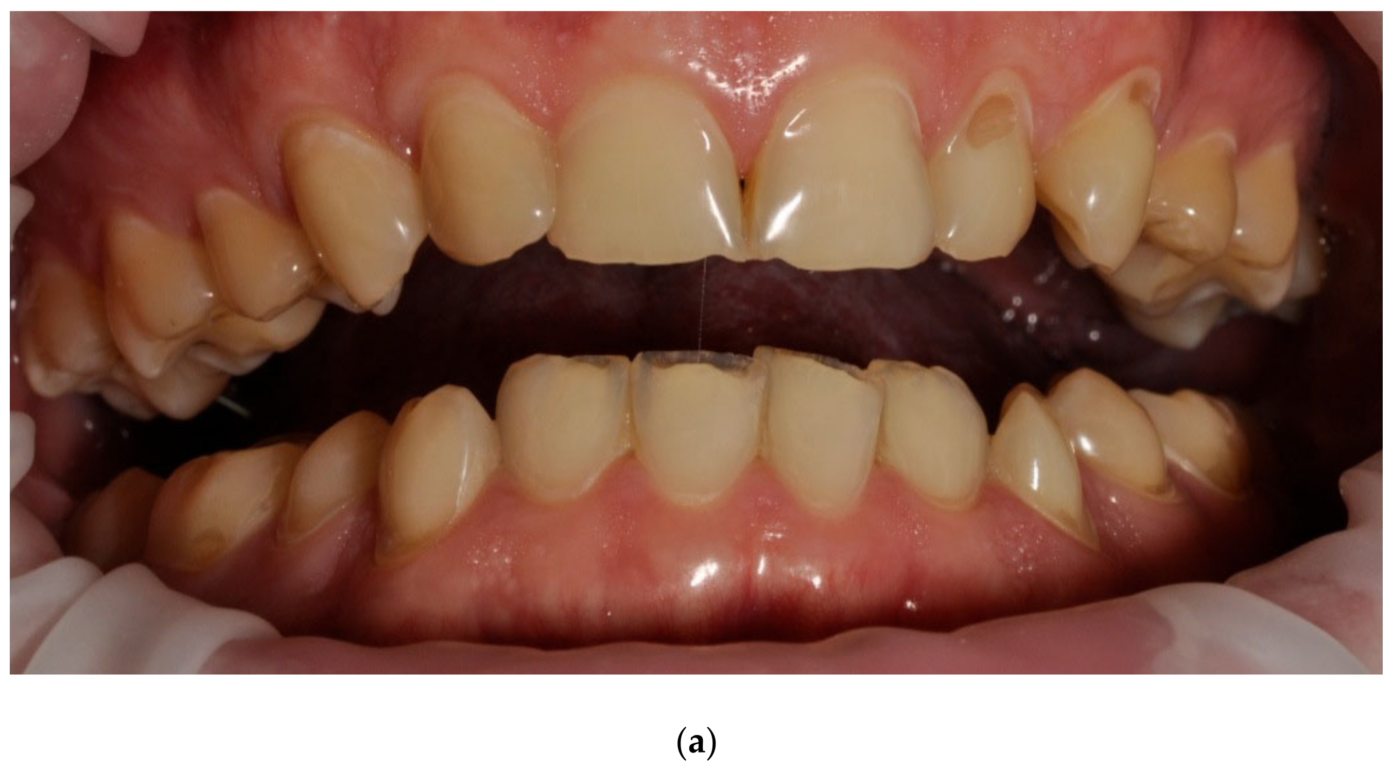 Ijerph 20 04792 g007a