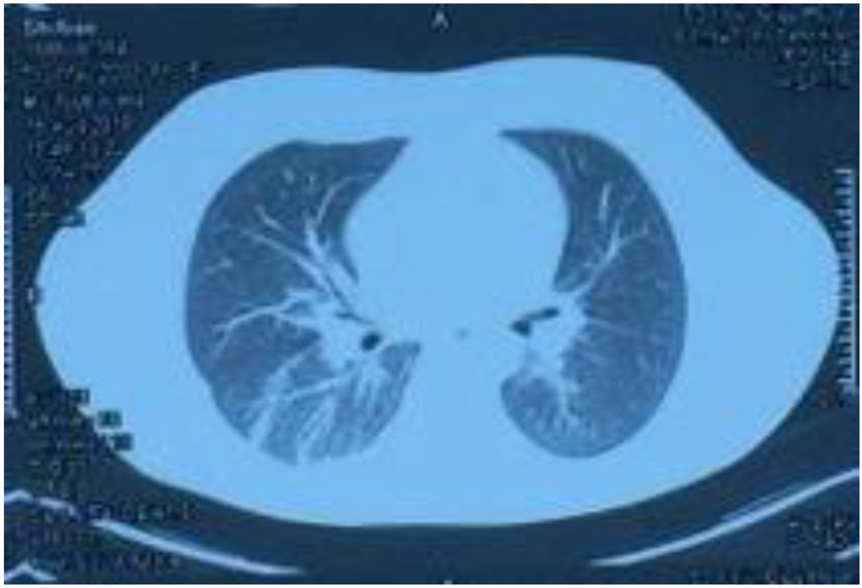 Ijerph 20 05021 g003