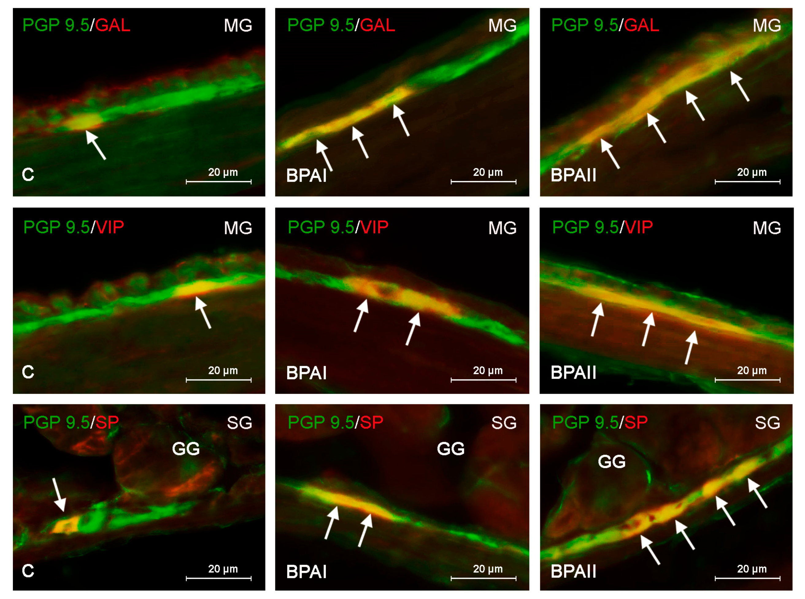 Ijerph 20 05125 g001