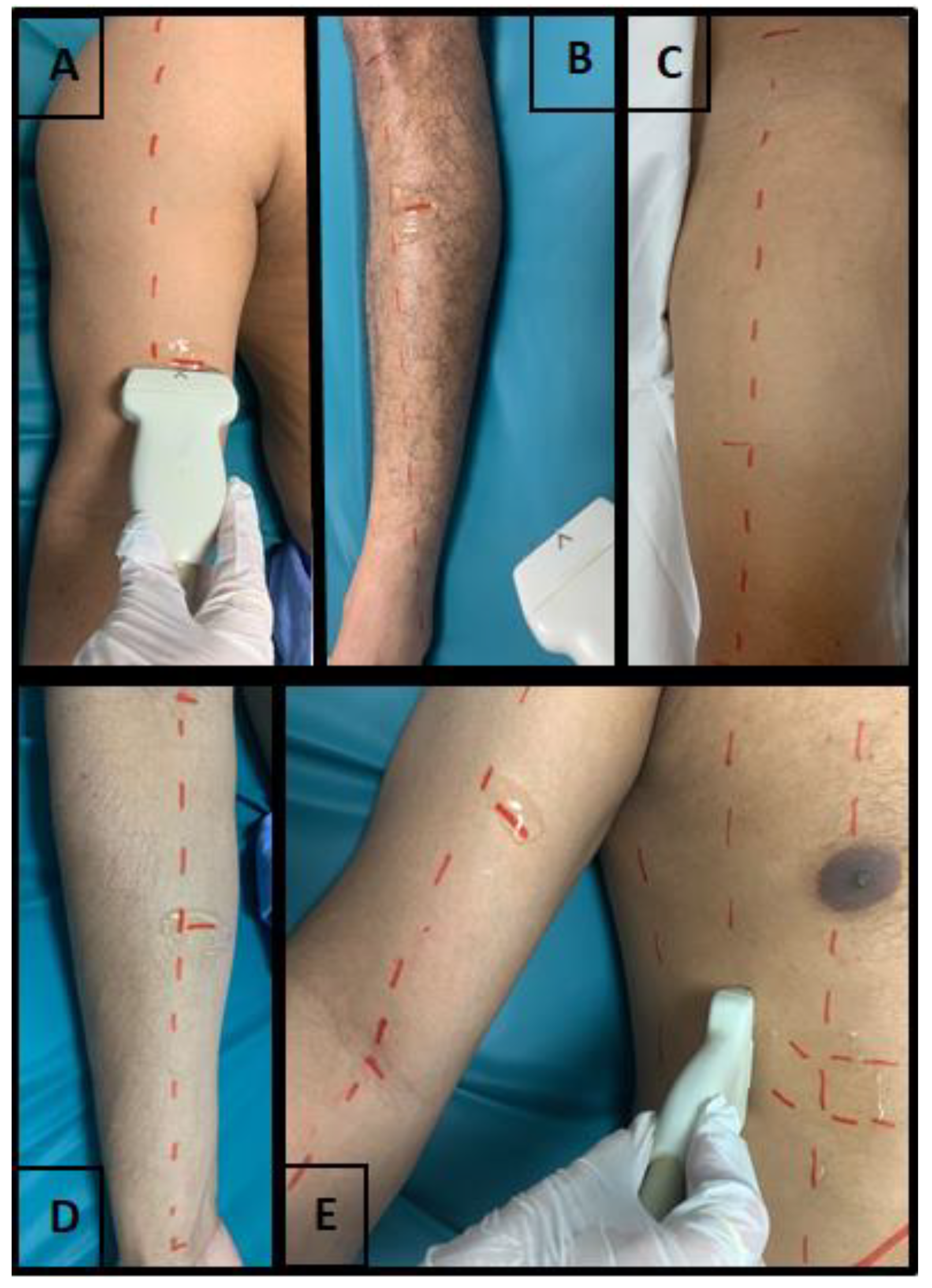 Ijerph 20 05636 g001 Ijerph 20 05636 g001