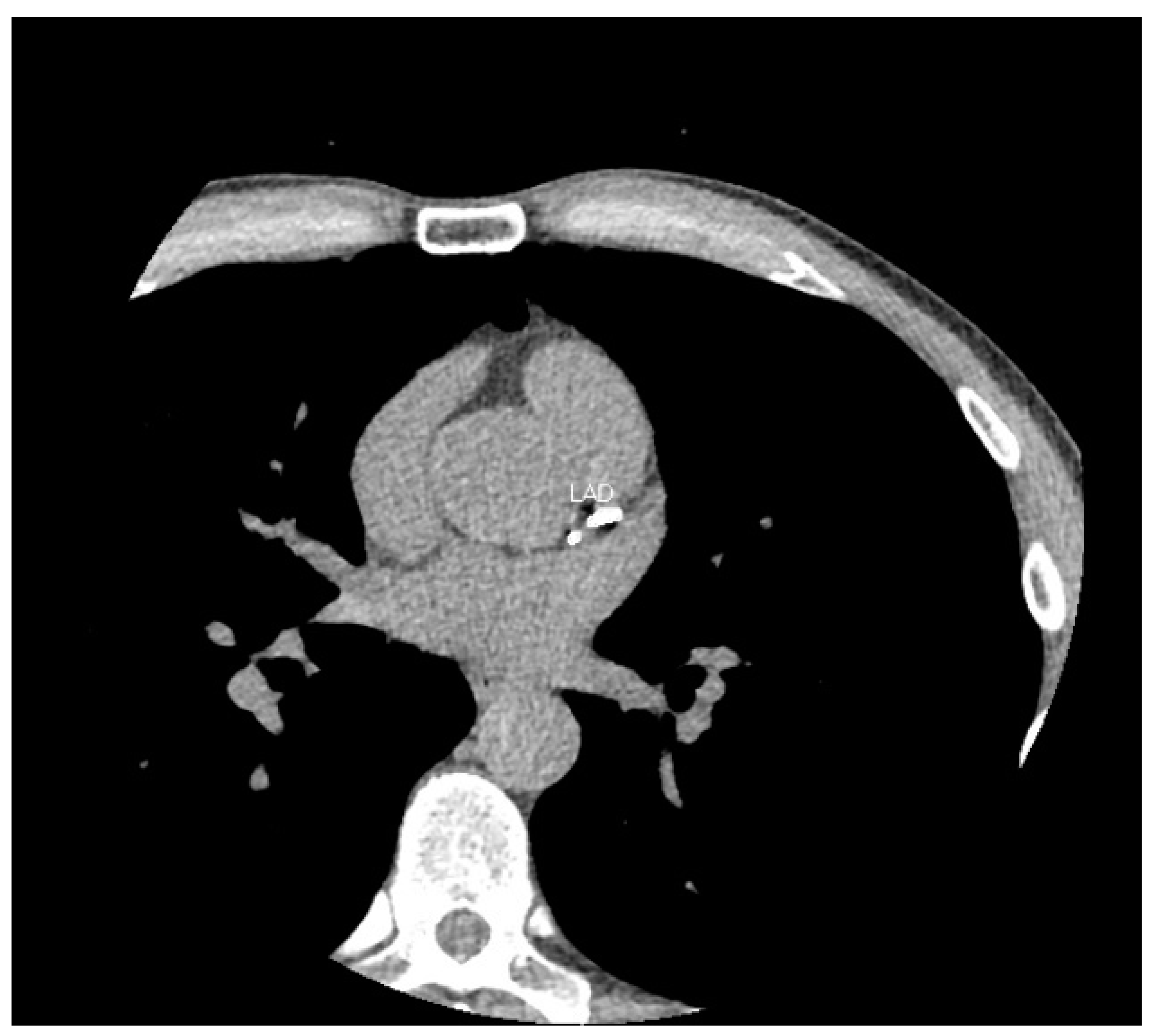 Ijerph 20 05699 g001 Ijerph 20 05699 g001