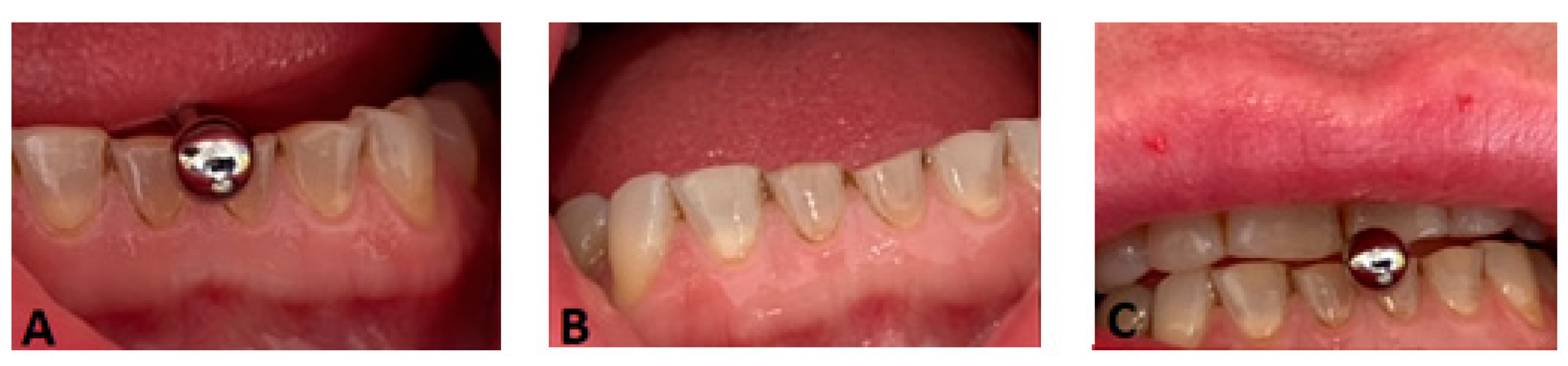 Ijerph 20 05744 g003