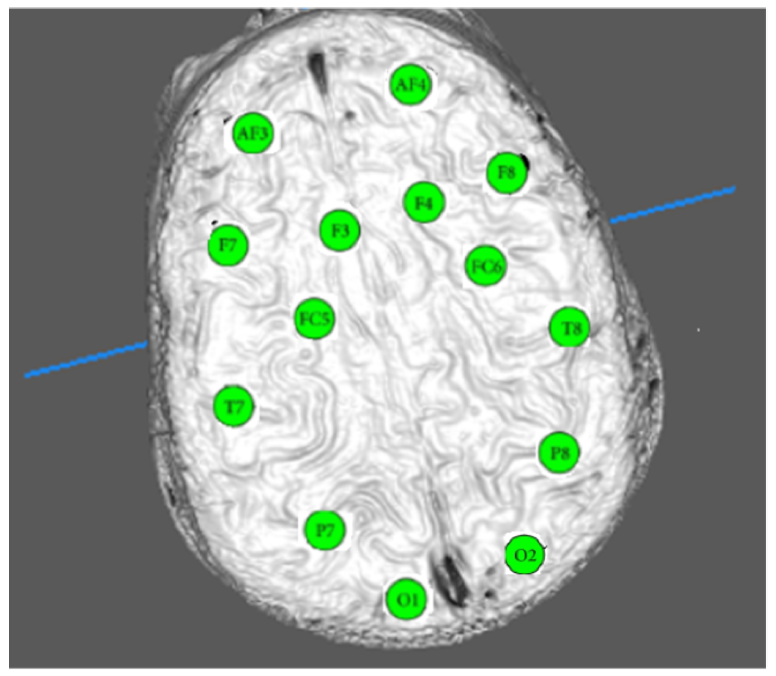 Ijerph 20 05913 g001