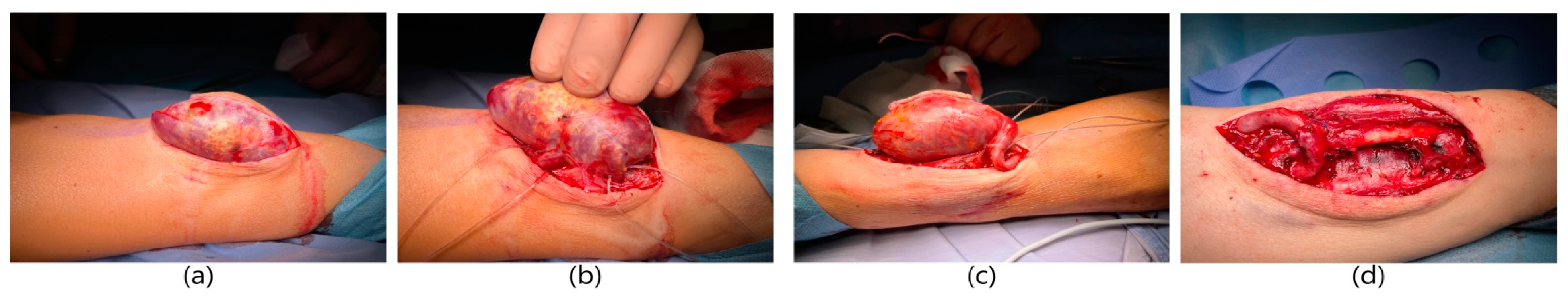 Ijerph 20 06256 g001