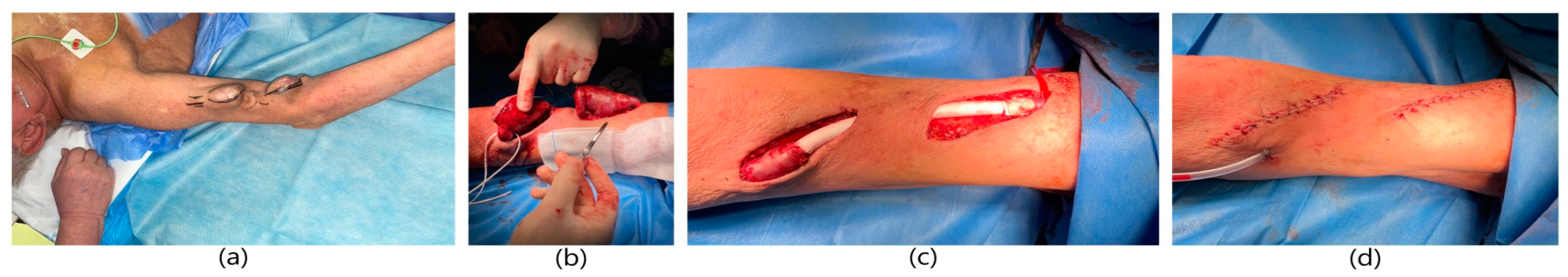 Ijerph 20 06256 g004