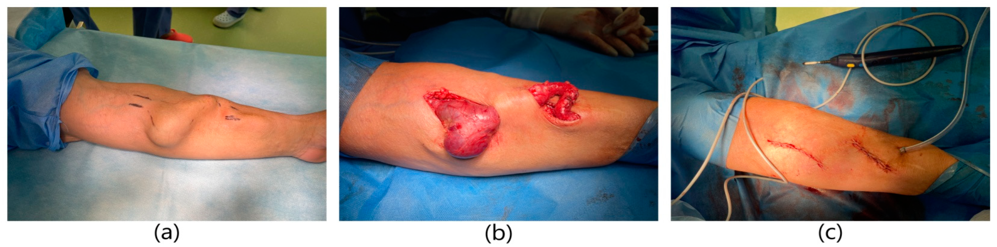 Ijerph 20 06256 g005