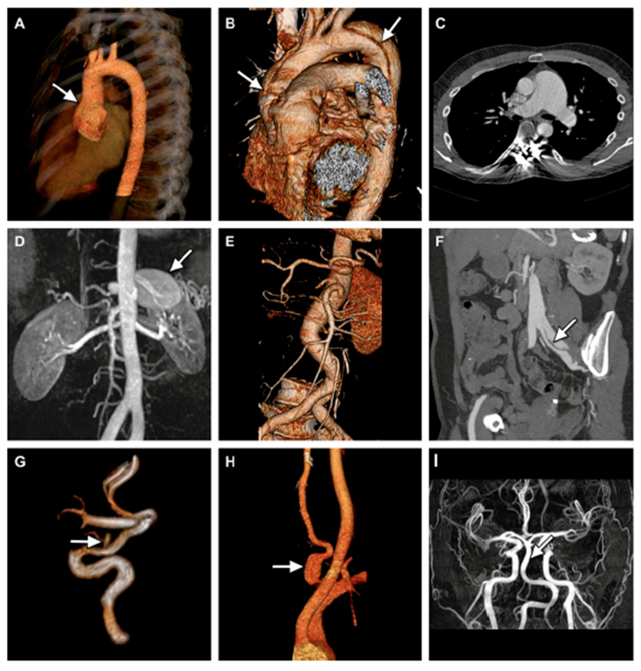 Ijerph 20 06615 g009