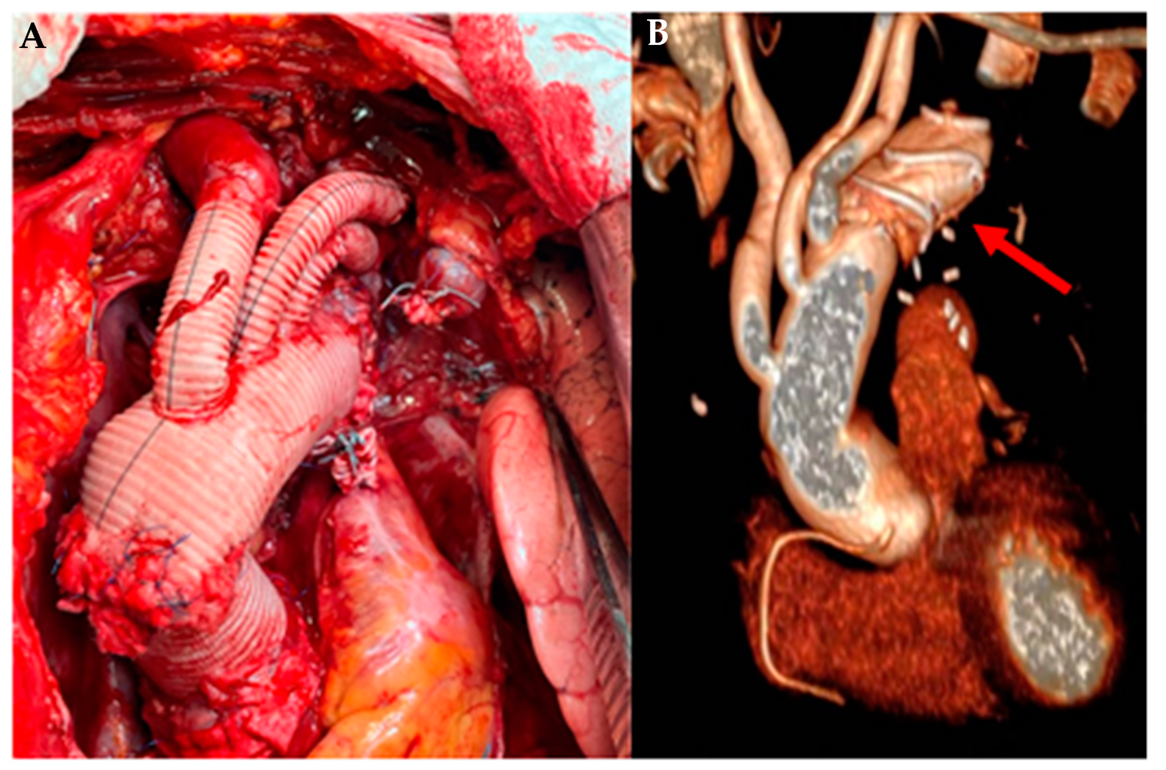 Ijerph 20 06615 g011