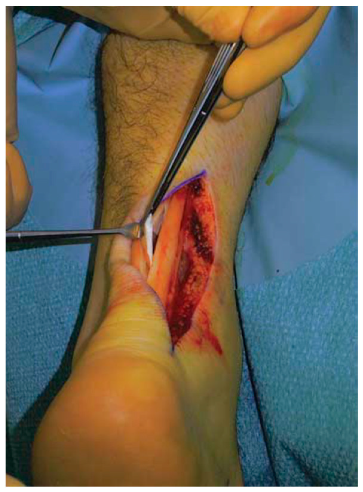 Ijerph 20 06681 g006