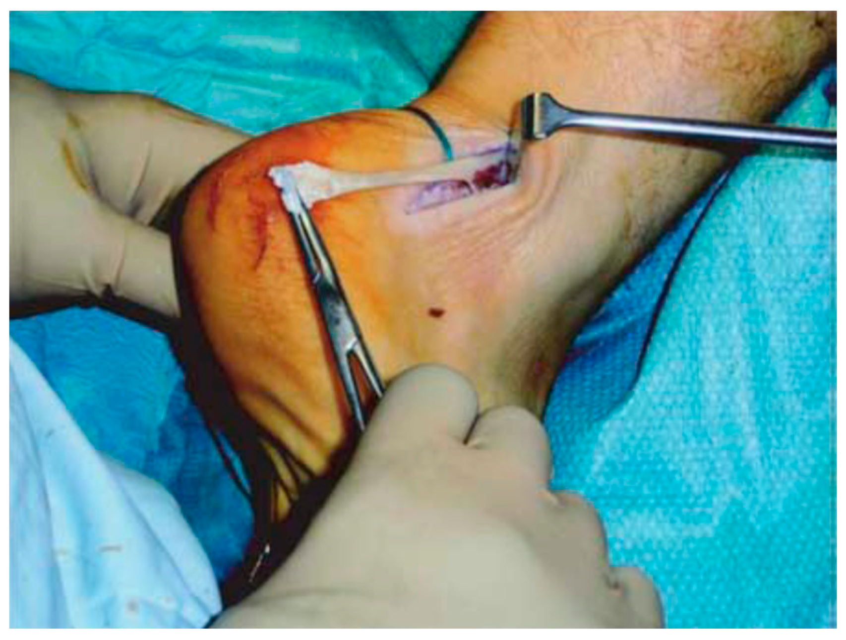 Ijerph 20 06681 g007