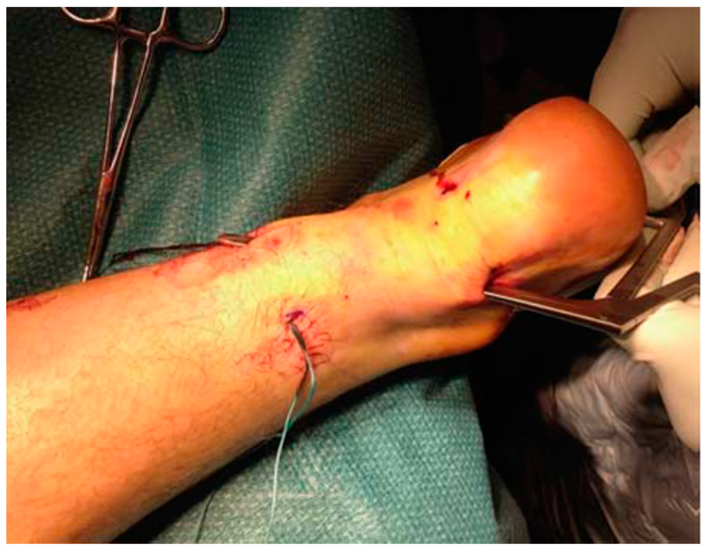 Ijerph 20 06681 g009