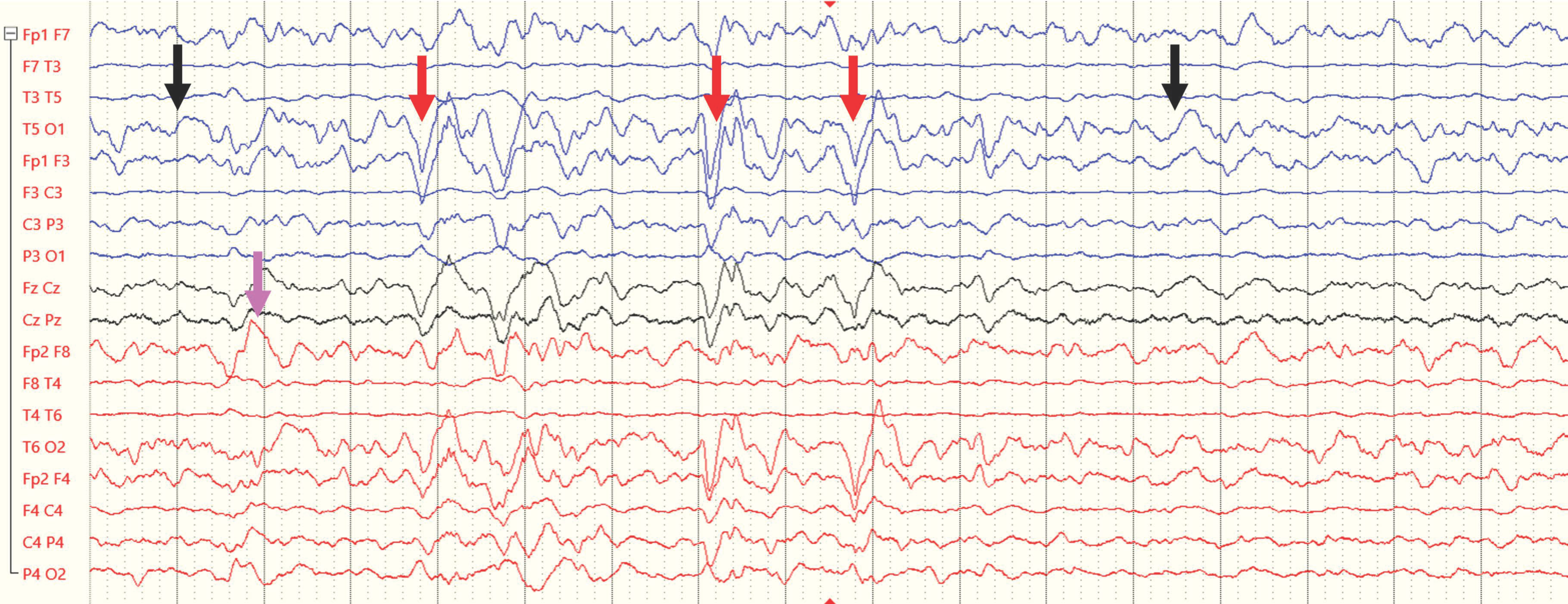 Ijerph 21 01466 g002