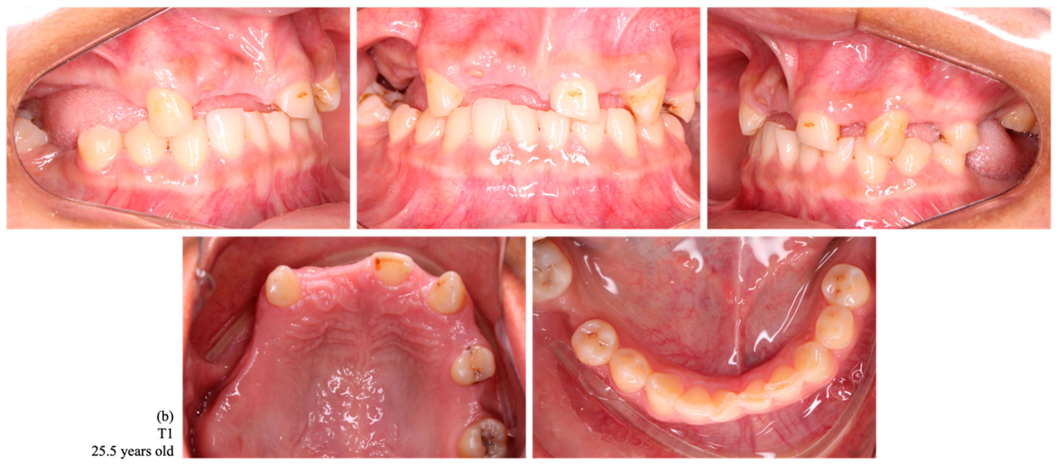 Ijerph 22 00128 g003b