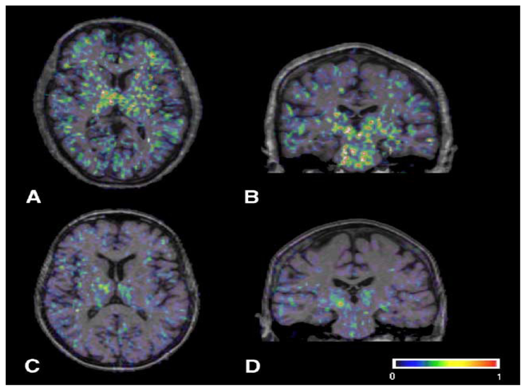 Ijms 12 00506f4 1024