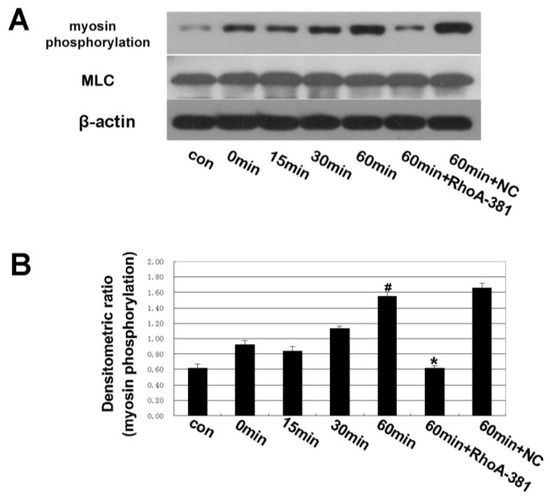 Ijms 14 03946 g005 550