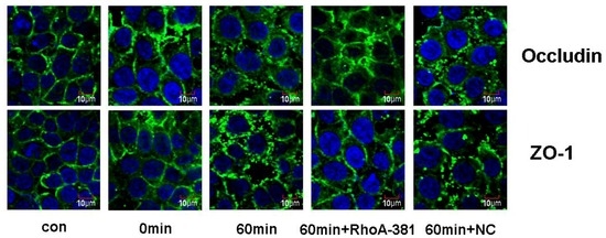 Ijms 14 03946 g007 550