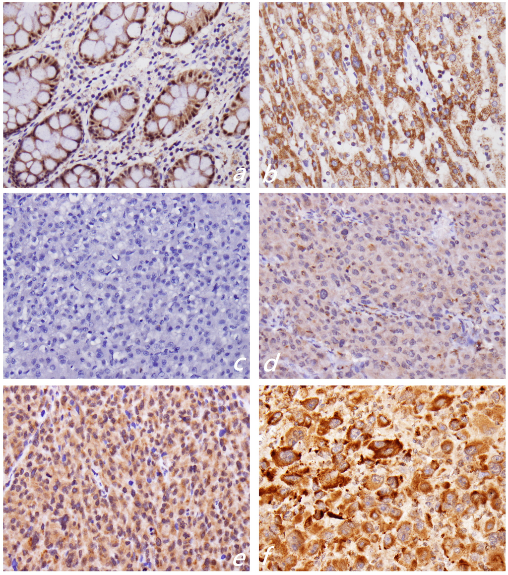 Ijms 15 09894 g001 1024