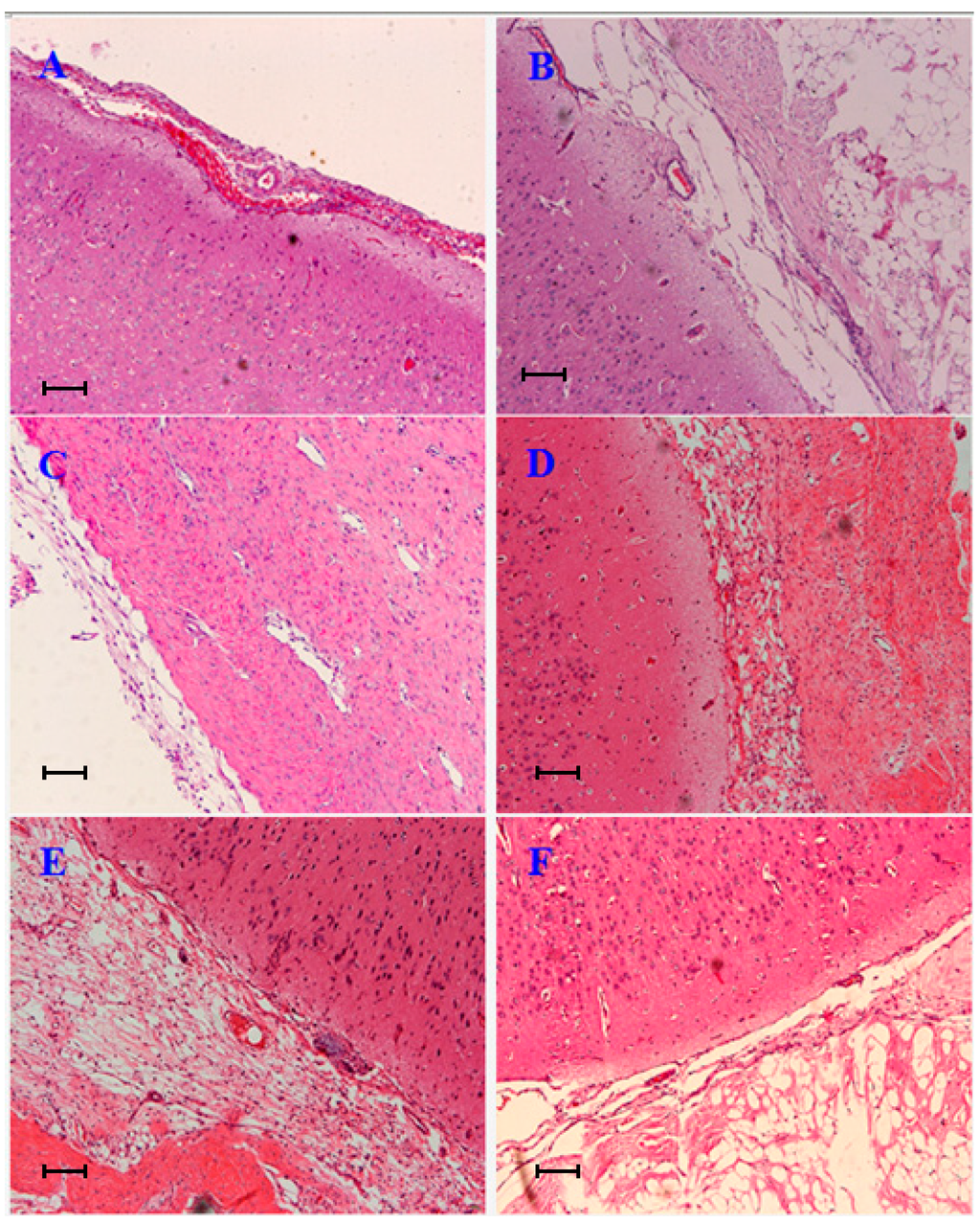 Ijms 15 10855 g003 1024