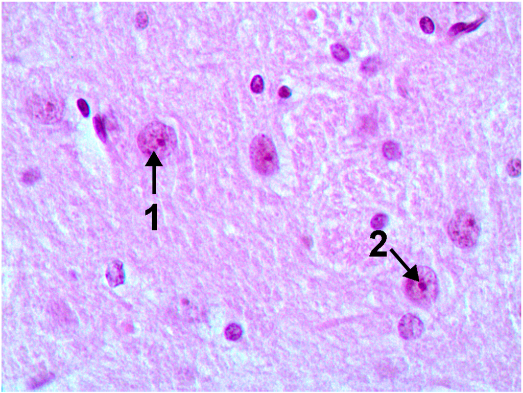 Ijms 15 12379 g007 1024