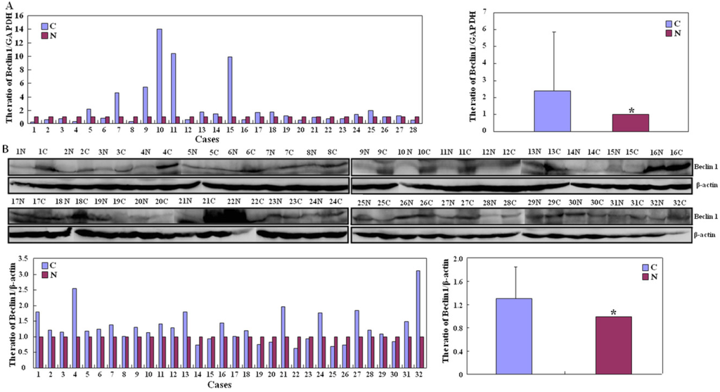 Ijms 15 14372 g002 1024