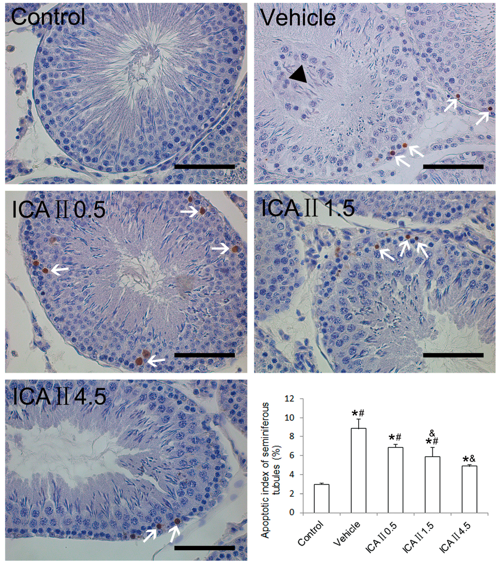 Ijms 15 16100 g005 1024