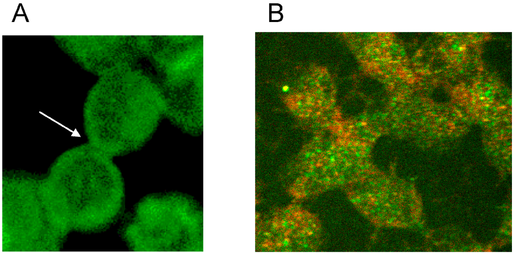 Ijms 15 16134 g006 1024