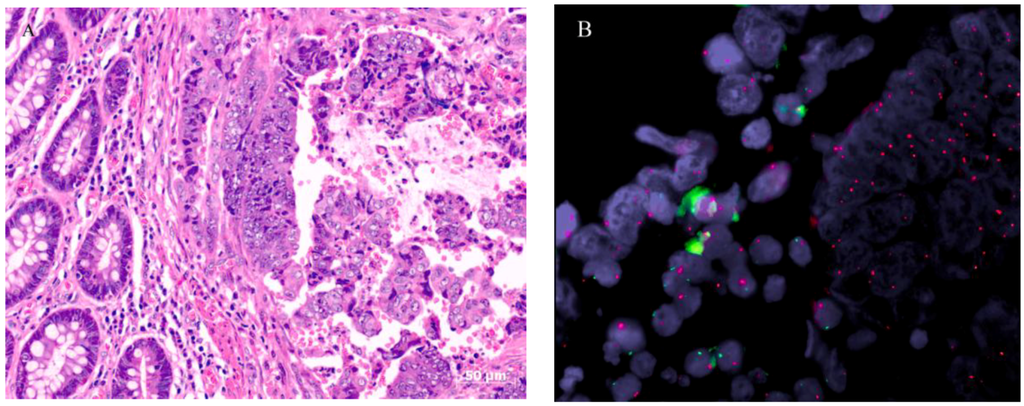 Ijms 15 17344 g003 1024