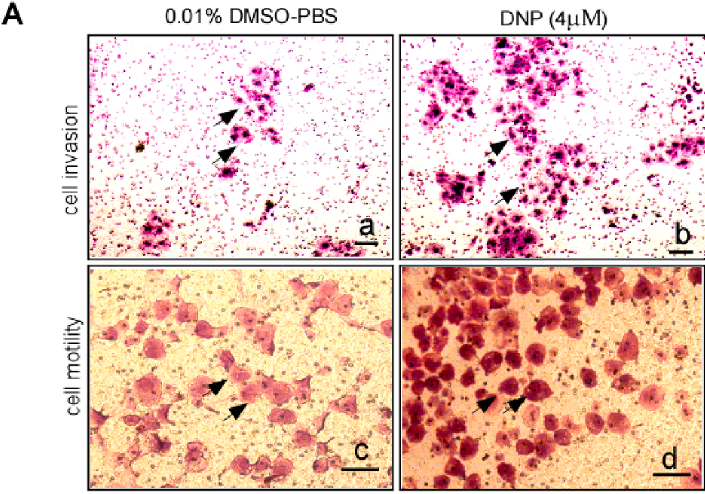 Ijms 15 20054 g002a 1024