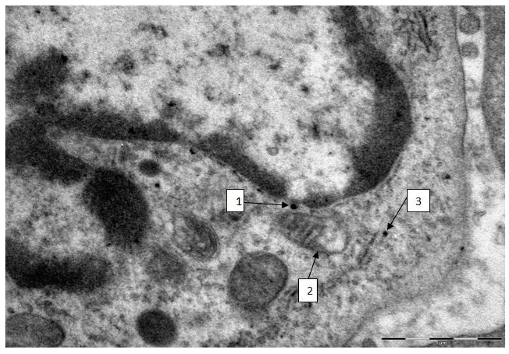 Ijms 15 21538 g003 1024