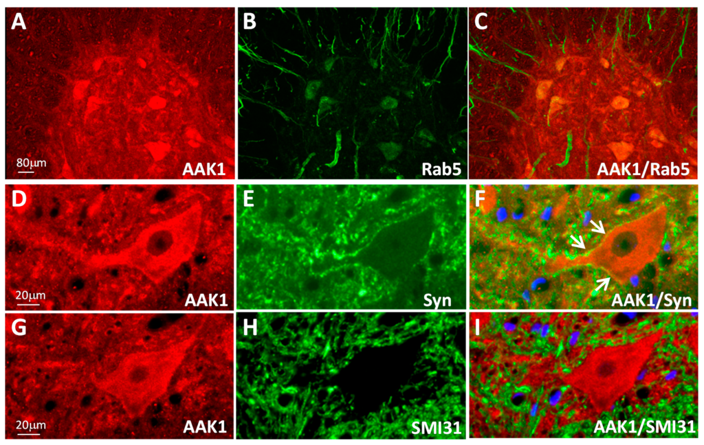 Ijms 15 22918 g002 1024