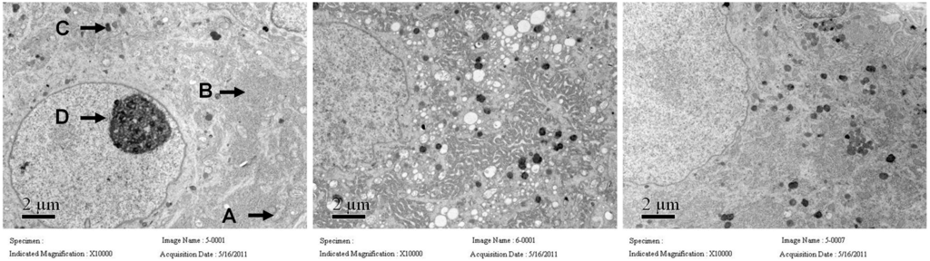 Ijms 15 23294 g005 1024