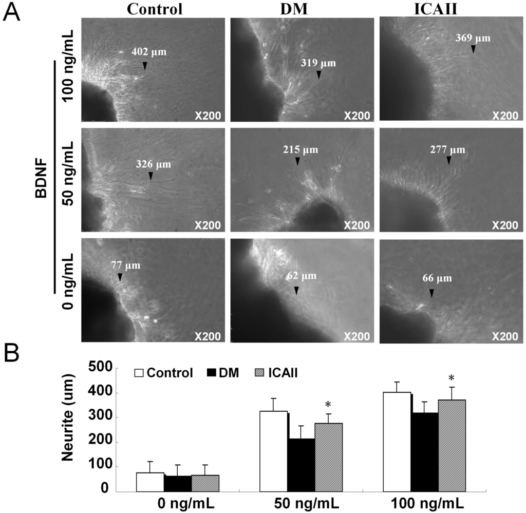 Ijms 15 23294 g006 1024