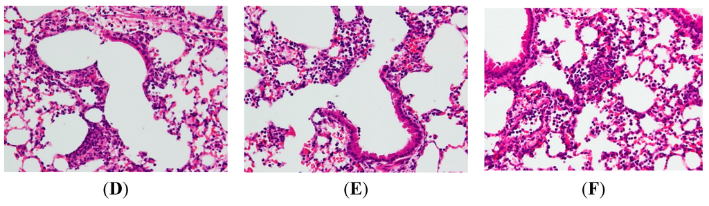 Ijms 16 01736 g002b 1024