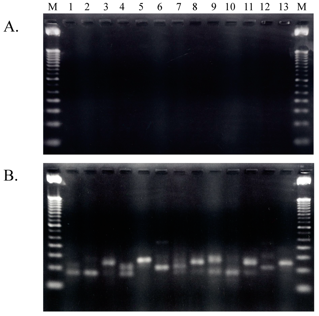 Ijms 16 02187 g002 1024