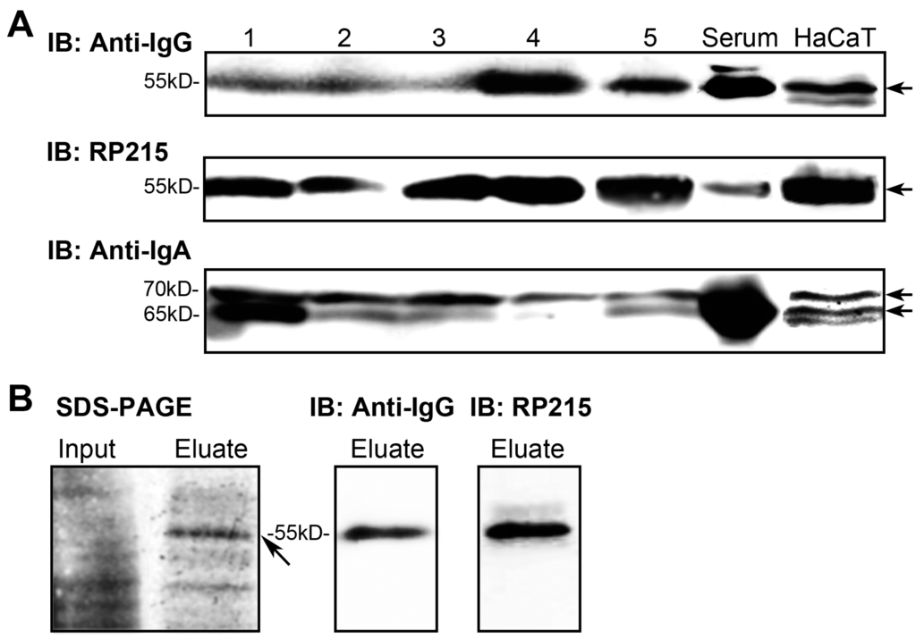 Ijms 16 02574 g002 1024