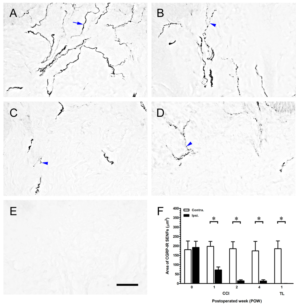 Ijms 16 04642 g003 1024