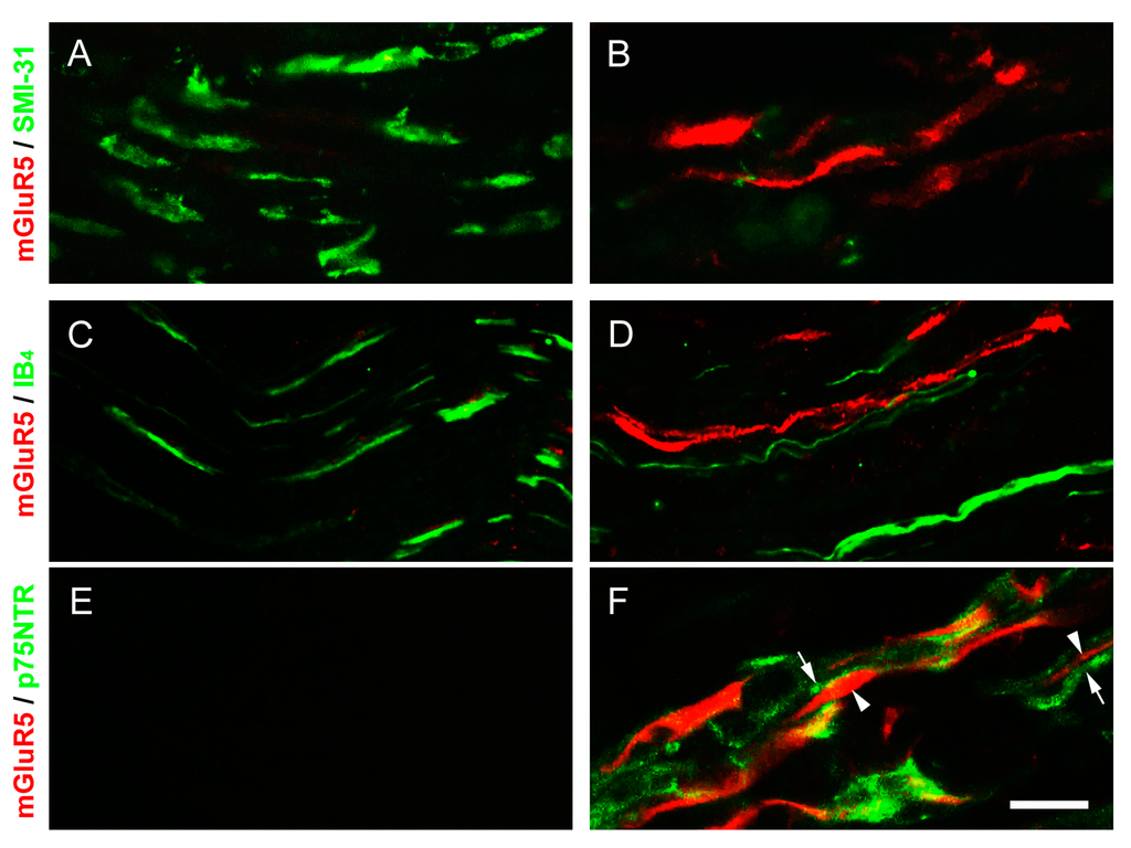 Ijms 16 04642 g007 1024