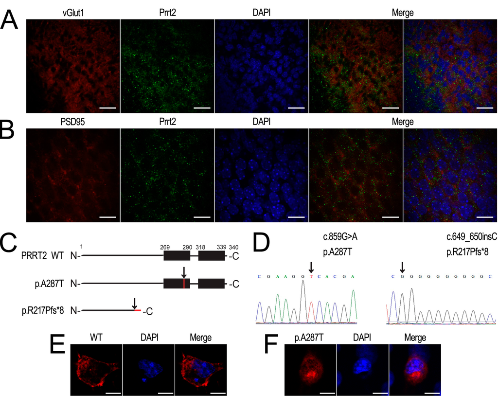 Ijms 16 09134 g003 1024