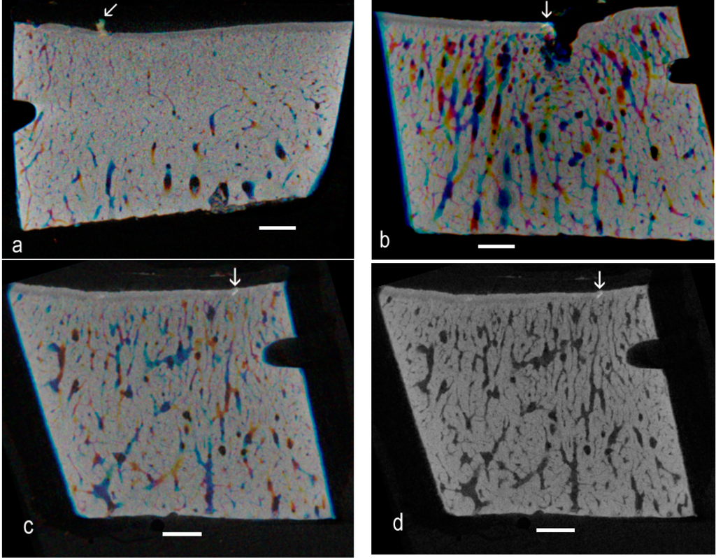 Ijms 16 09600 g003 1024