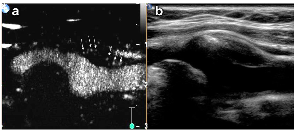 Ijms 16 09749 g003 1024